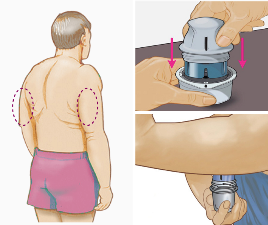 jak założyć sensor freestyle libre 2