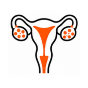 PCOS